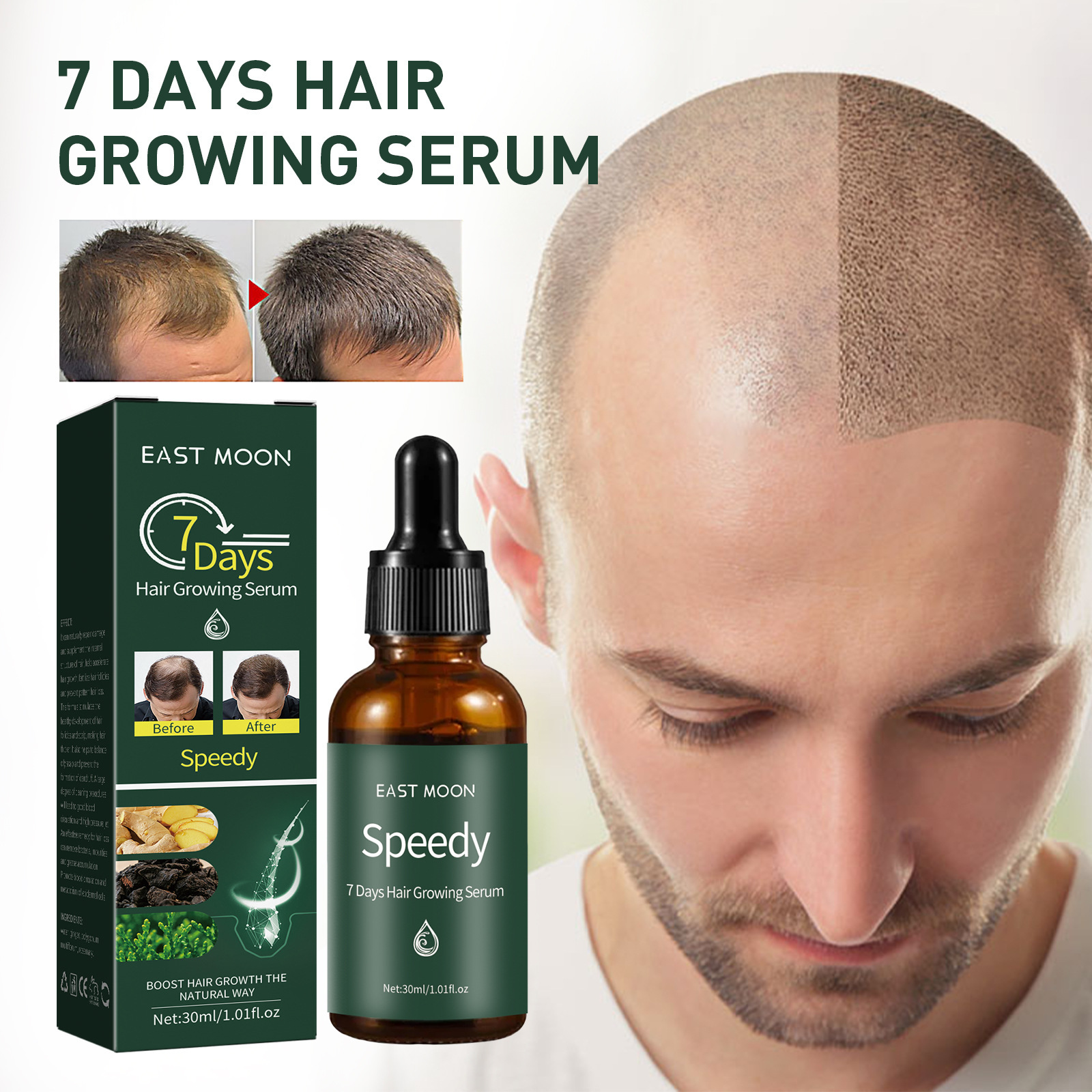 New Hairline Anti-drop - Image 3