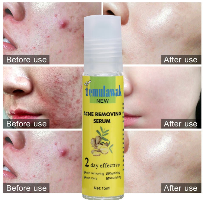 Temulawak - New Acne Removing Serum 3