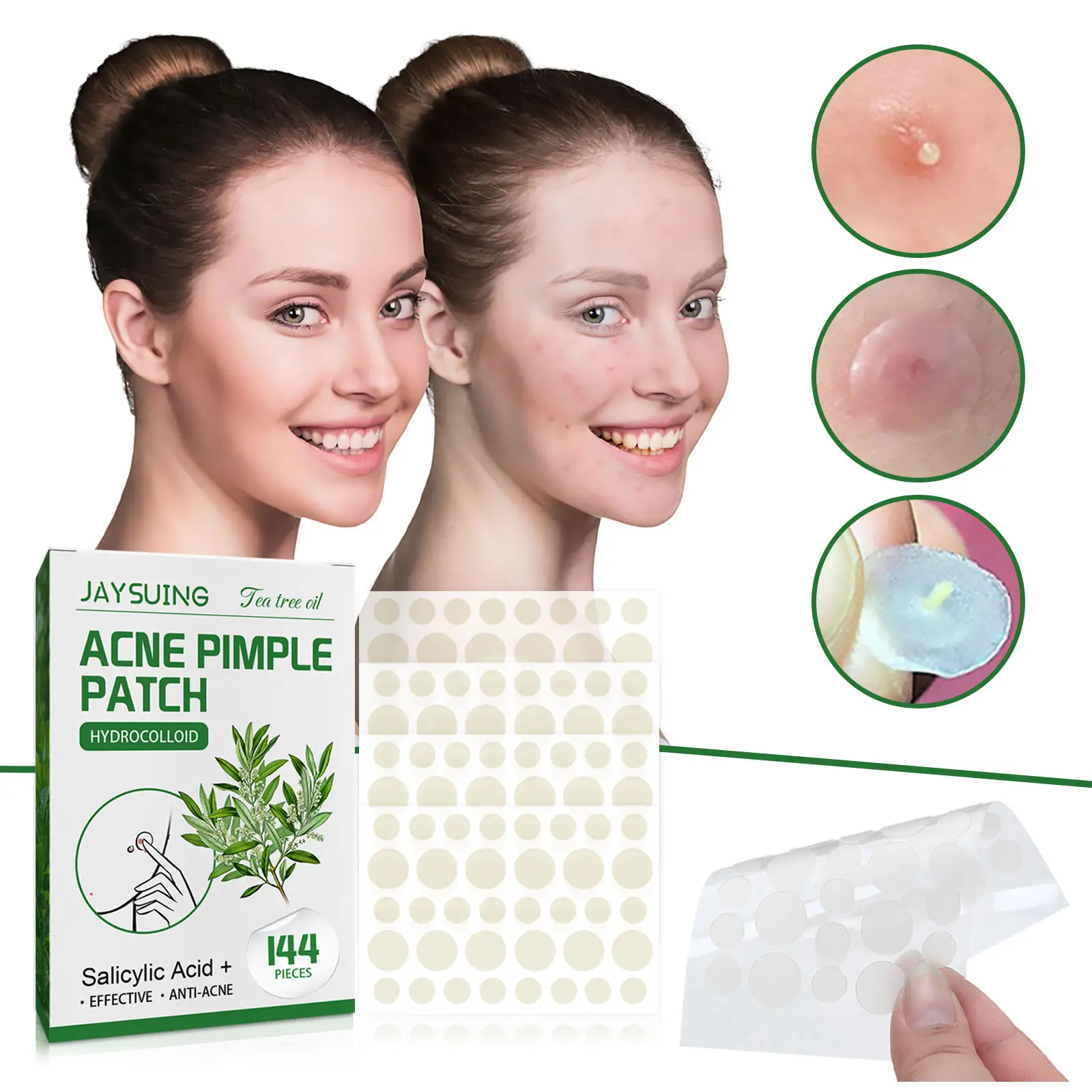 Acne Pimple Patches, Hydrocolloid Patches