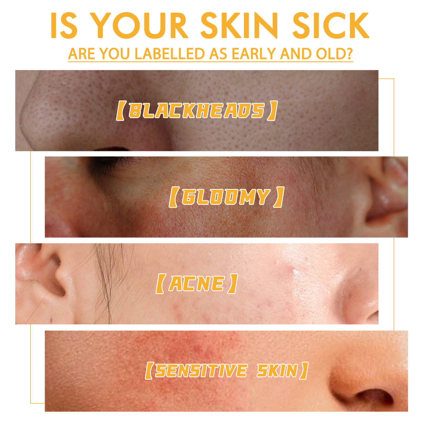 Firming Pores Dark Yellow Brightening Skin Color Apply Honey Tearing Mask