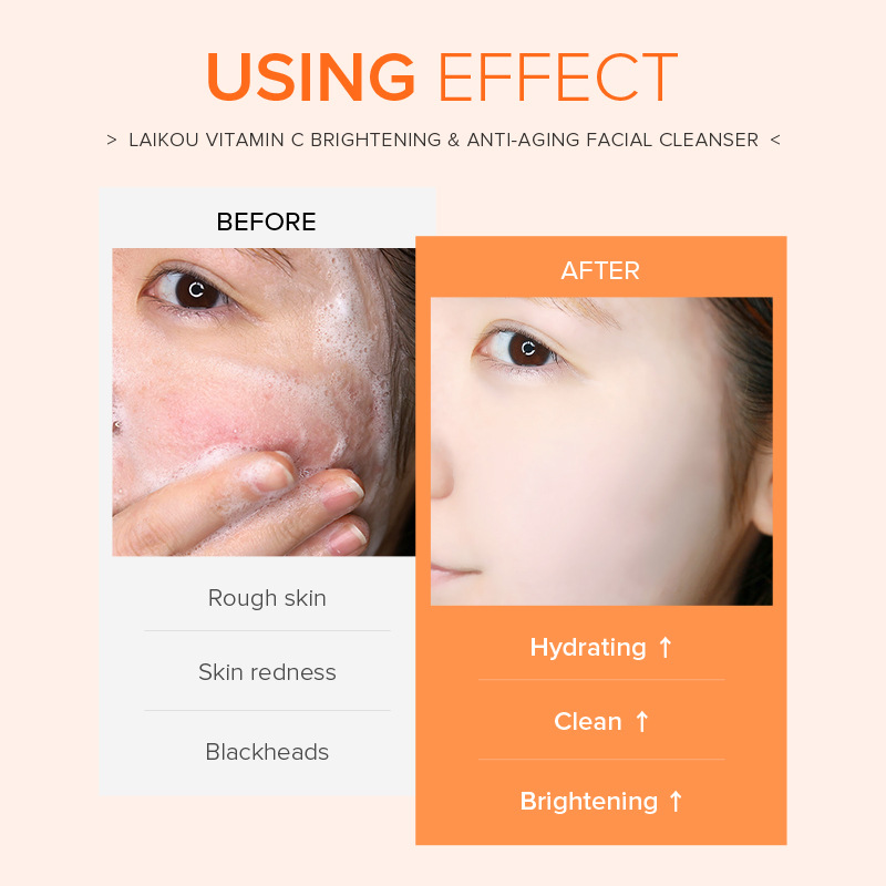 Laikou Vitamin C Skincare Cleanser