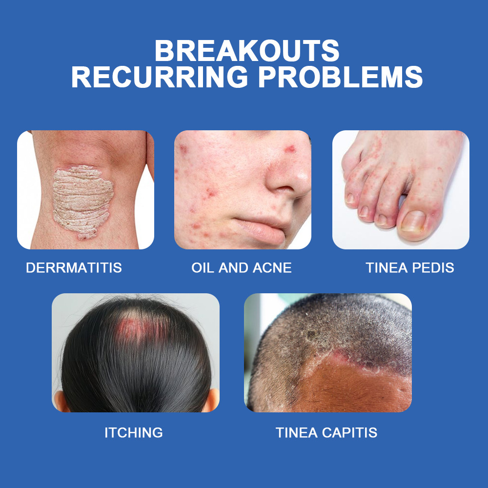 Plaster Tea Tree Oil Skin Care Cream