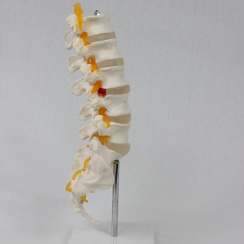 5-Lumbar-Sacral Spine Model With Type Nerve Distribution  Orthopedic Teaching Demonstration Tool
