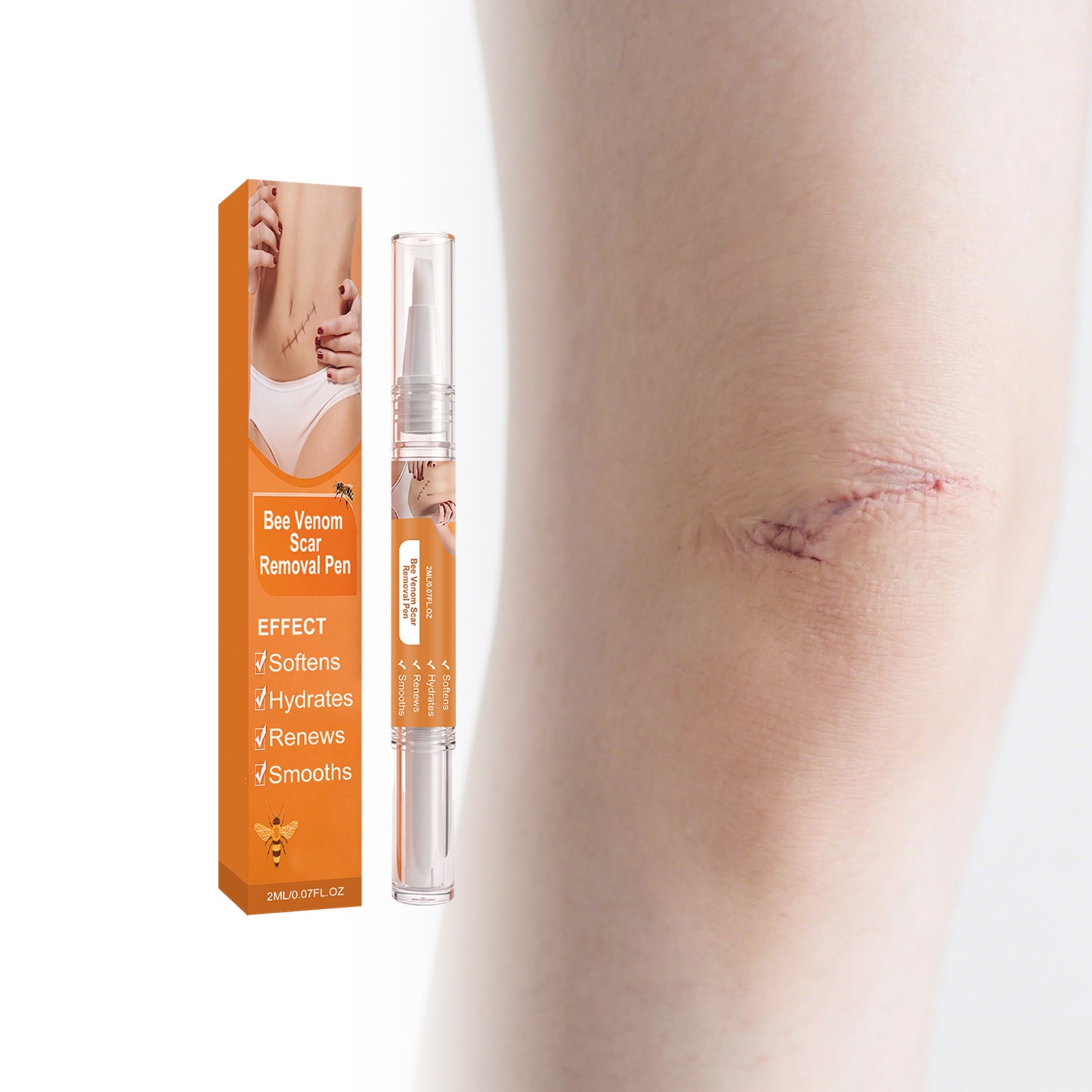 Scar-removal Pen