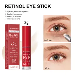 Eye Cream Stick Moisturizing Eye Skin Fading Wrinkle Fishtail Pattern Dark Circles - Retinol Eye Cream Stick Abroad - View 1