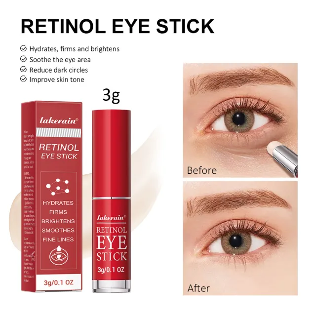 Eye Cream Stick Moisturizing Eye Skin Fading Wrinkle Fishtail Pattern Dark Circles Retinol Eye Cream Stick Abroad - Shop at LoveMi