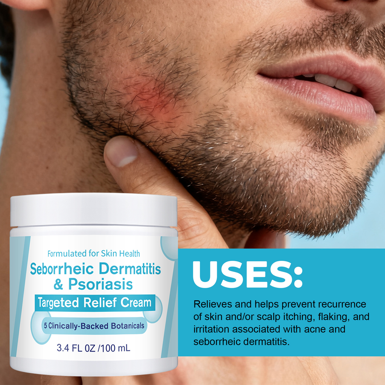 New Seborrheic Dermatitis Cream A Moisturizing Skincare Cream That Nourishes And Soothes The Skin