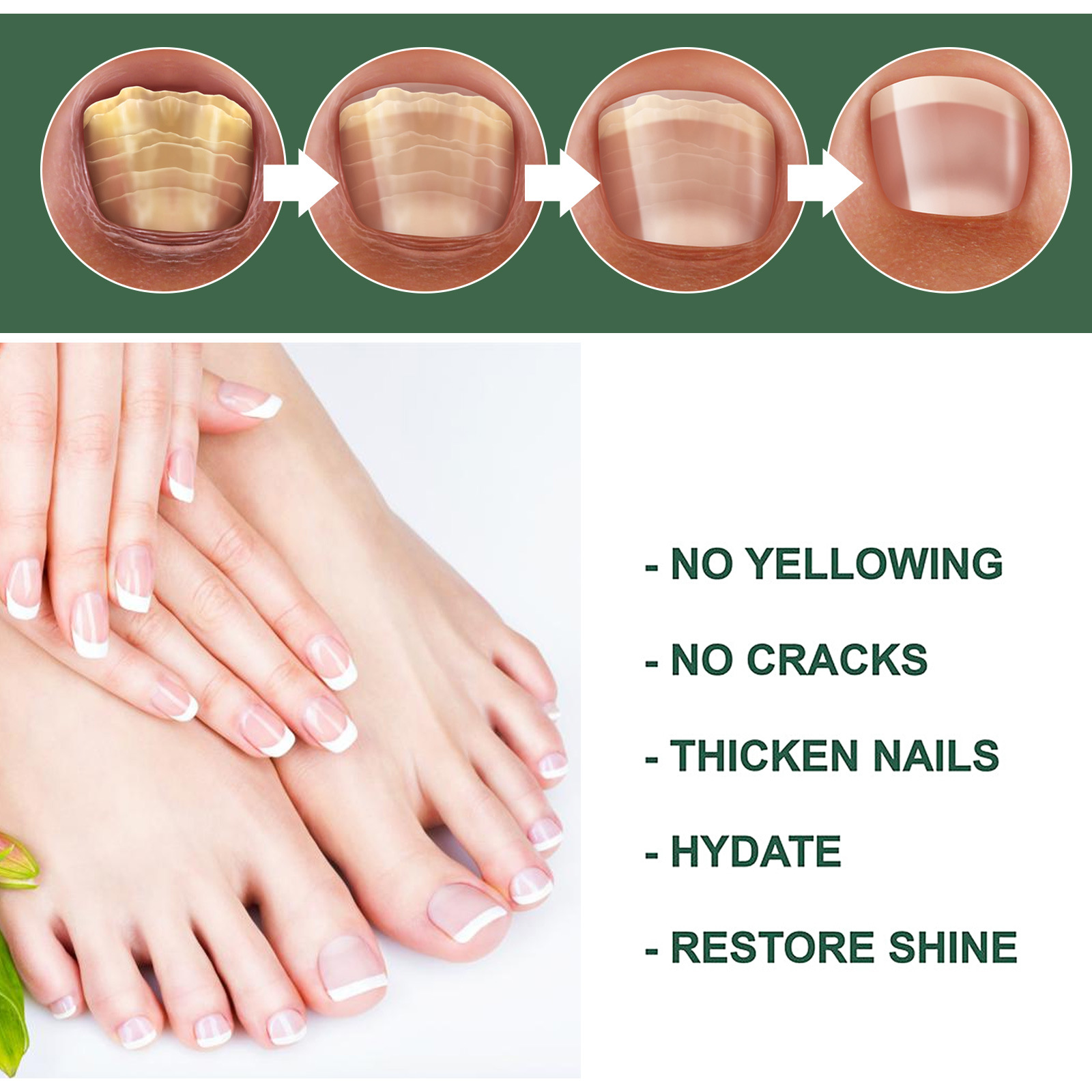 Title 8, Foot Care Solution Onychomycosis Nail Care Solu...