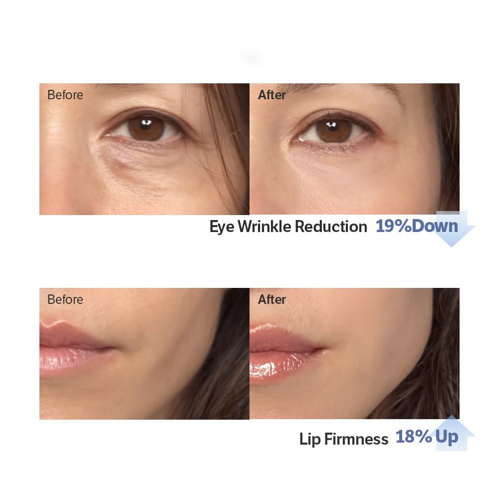 Deep Collagen Improves Skin Elasticity 3