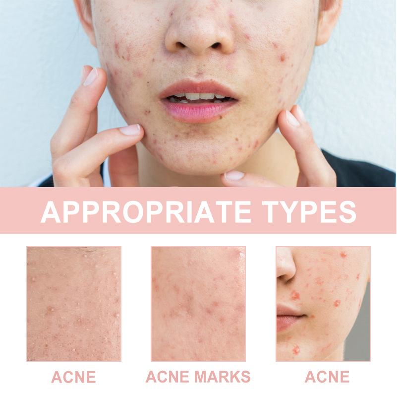 Title 14, Anti-Acne Repair Acne Marks Waterproof Conceale...