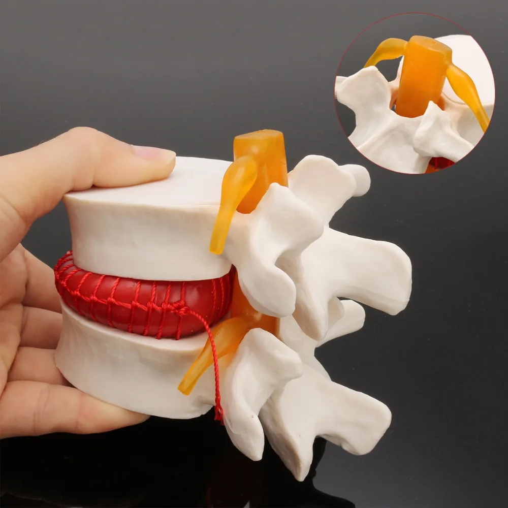 Title 2, Demonstratiemodel van de menselijke lumbale tus...