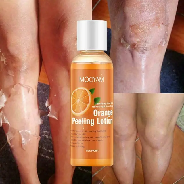 Instant Exfoliating Dead Skin Remover Brightening Exfoliating Gel Hot Gel - Shop at LoveMi