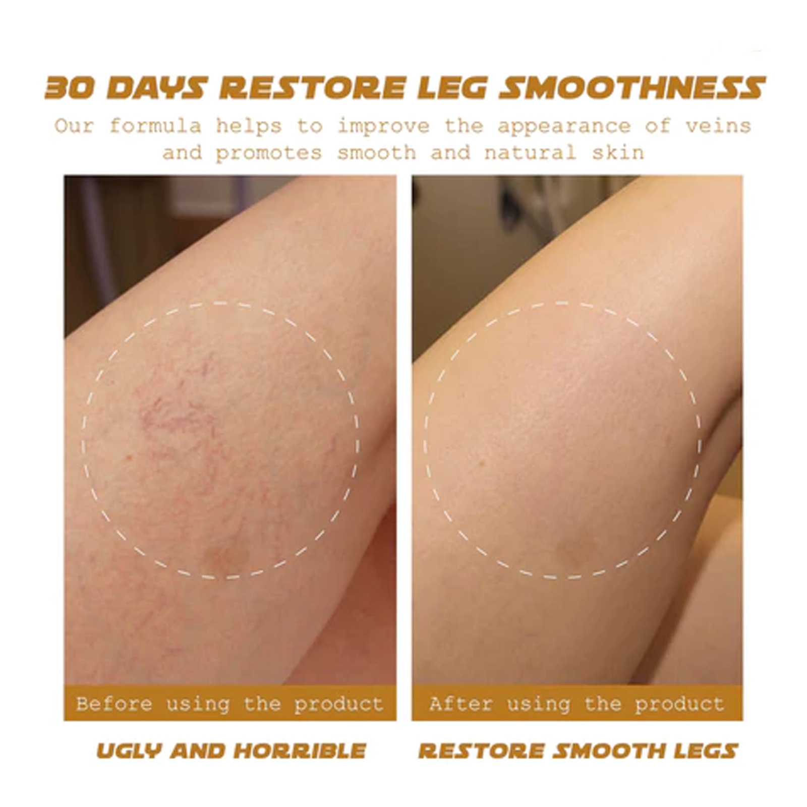 Venous Massage Cream To Soothe Sore Legs