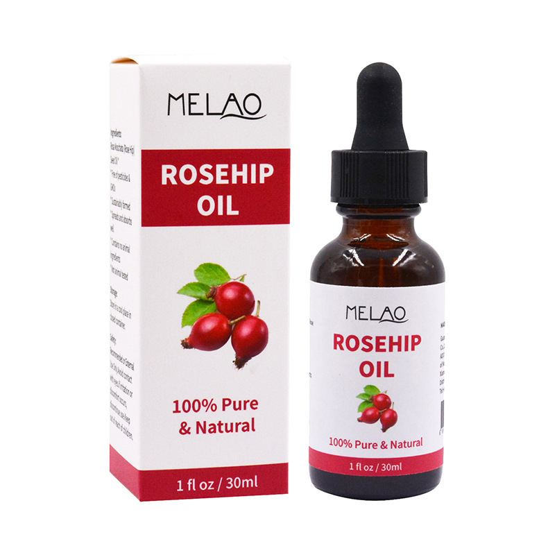 30ml Rosehip Oil