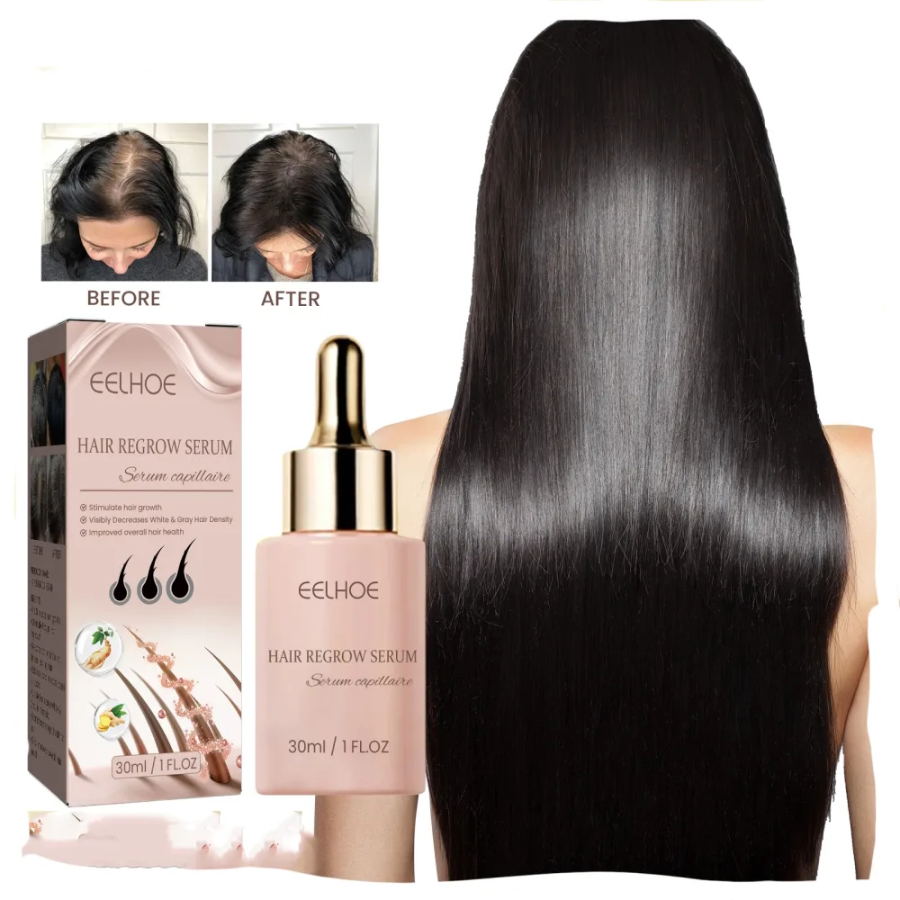 EELHOE Hair Dense Essence Anti-hair Loss and Fixation Nutrition
