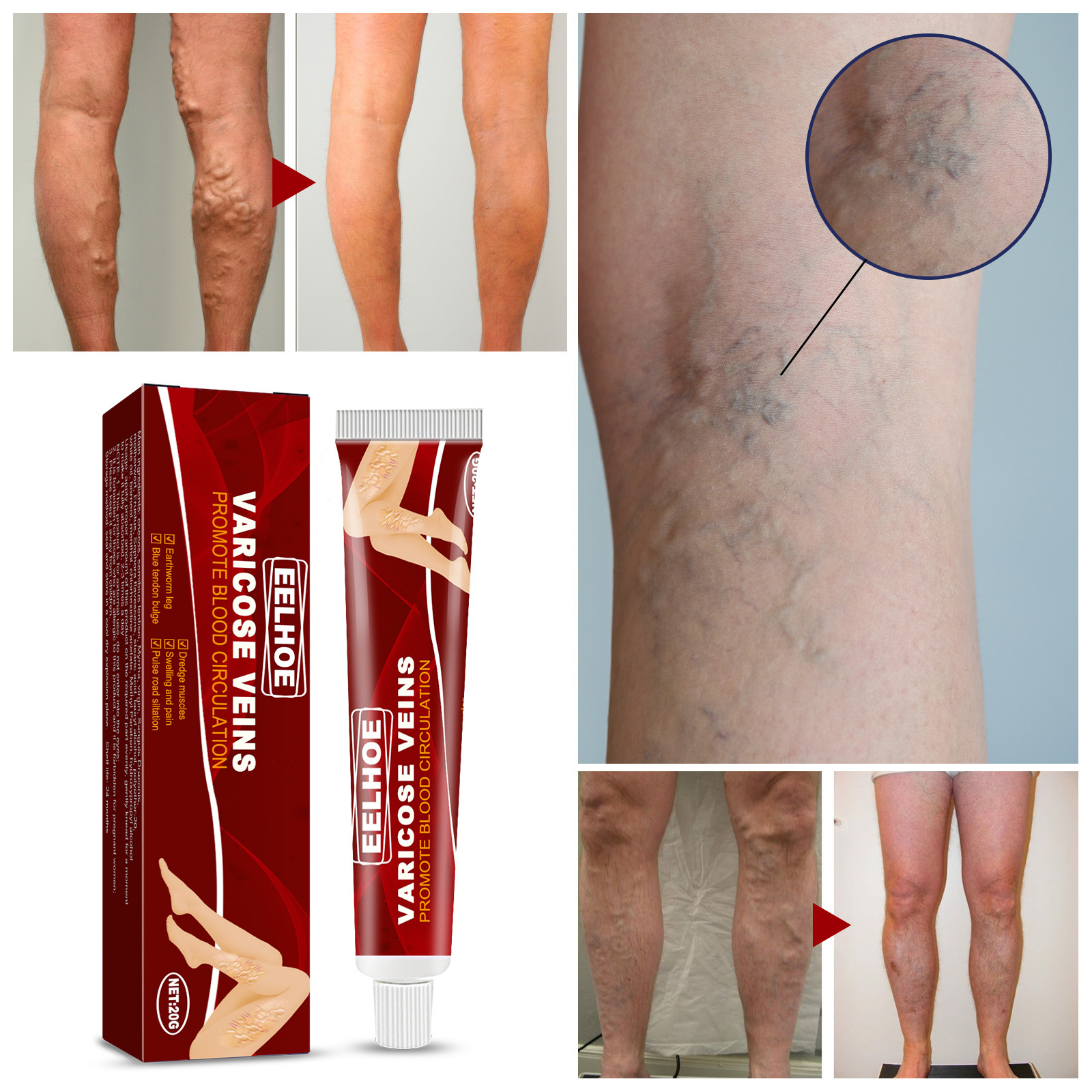 Title 3, Earthworm Leg Vein Massage Cream Relieves Leg V...