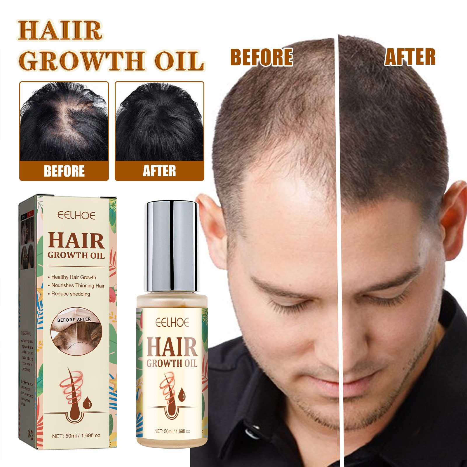 Title 1, Dry And Manic Hair Growth Care Essential Oil