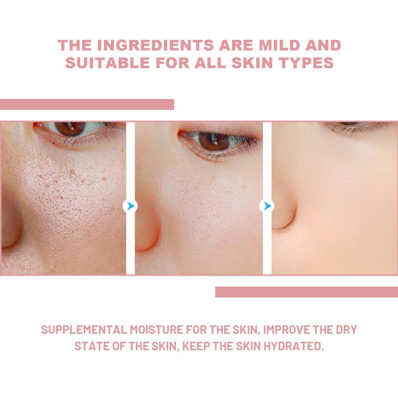 Nicotinamide Care Solution Hydrating And Moisturizing Improvement