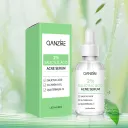 30Ml