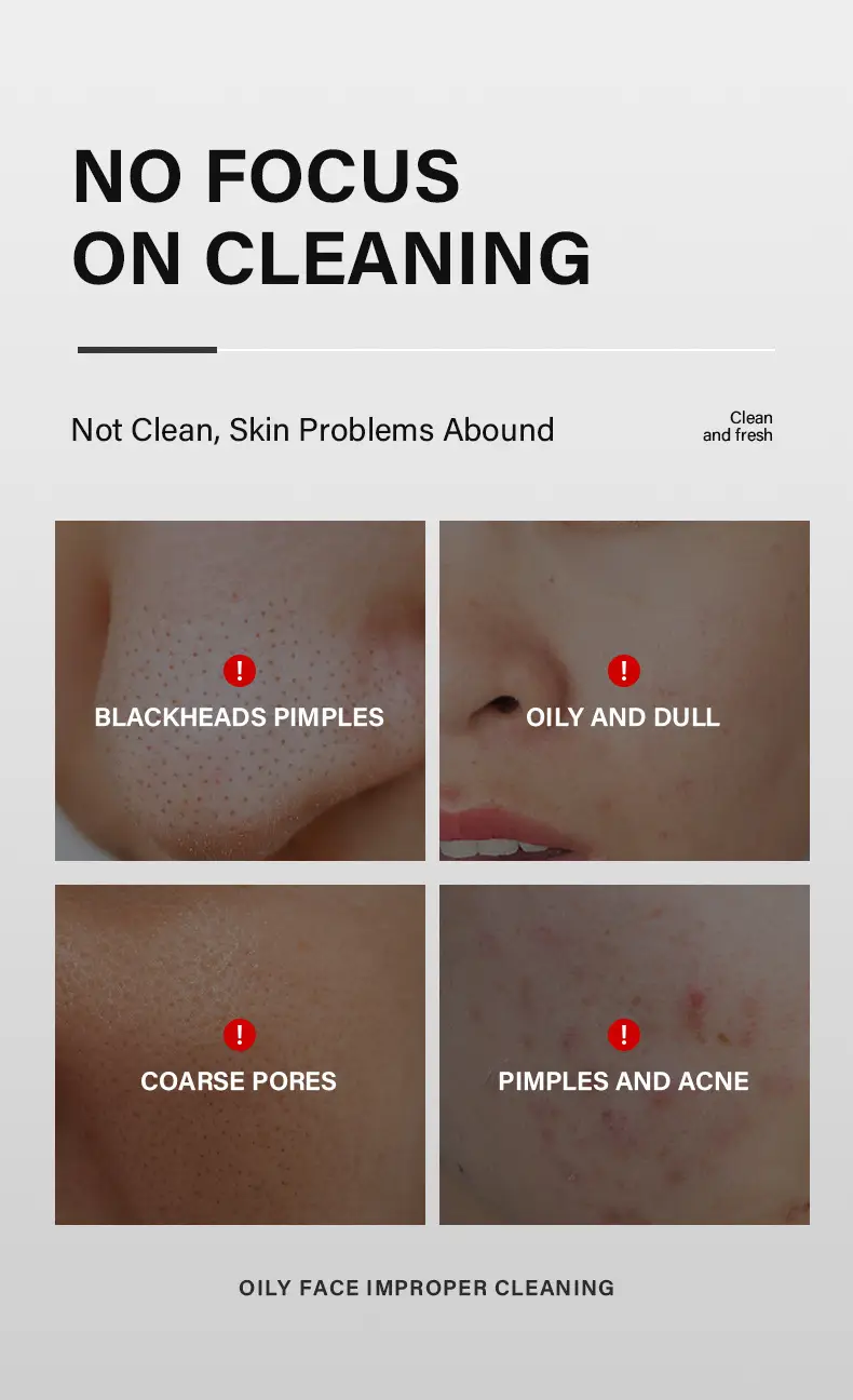 MUD MASK Daub-type MUD MASK Clean Blackheads