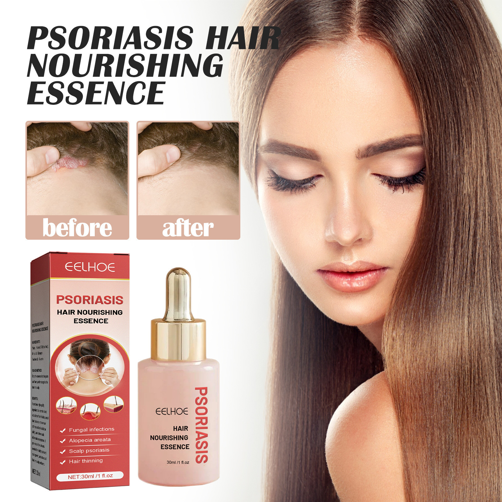 Daily Scalp Cleansing Serum For Flake-free Oil-control Care