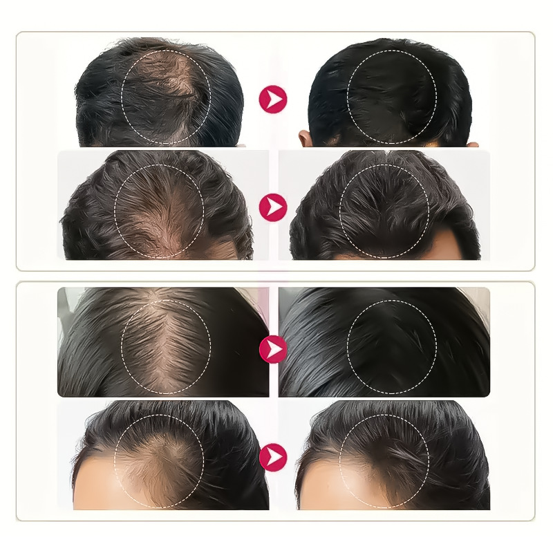 Title 3, Biotin Hair Nutrient Solution