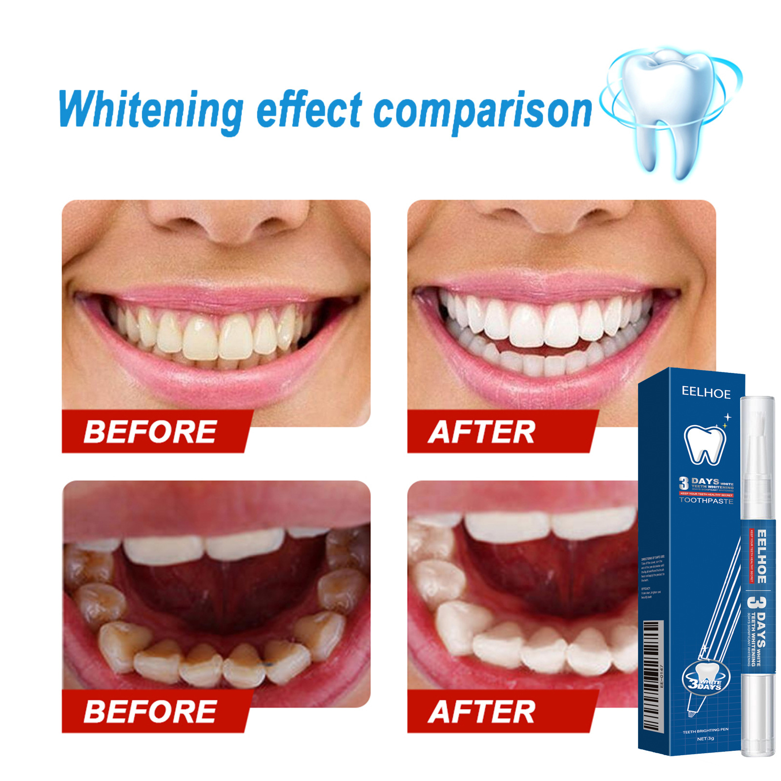 Teeth-cleaning Stain-removing Naturally Brightening Beauty