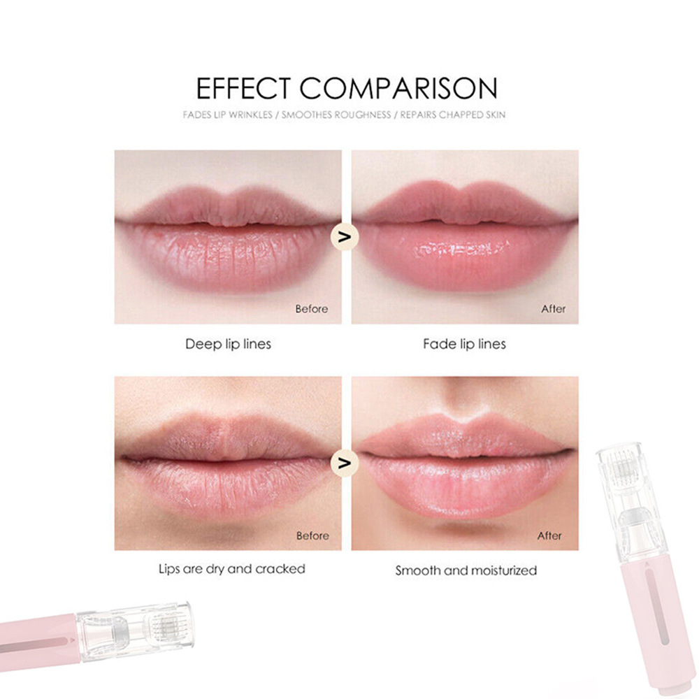 Title 12, Yifeng Lip Lippenmassagegerät mit Hochfrequenz-...