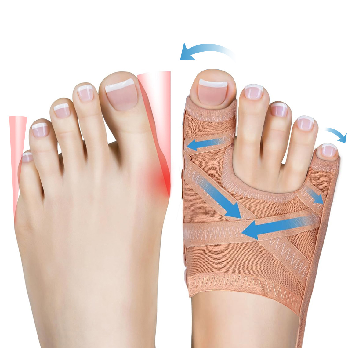 Adjustable Bunion Corrector Toe Separator - Image 4