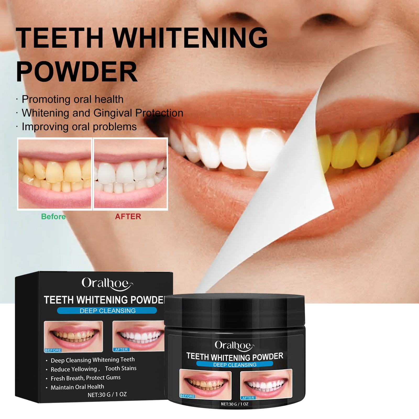 Bright Teeth Dental Care Removes Stains, Tobacco Stains, And Interdental Powder