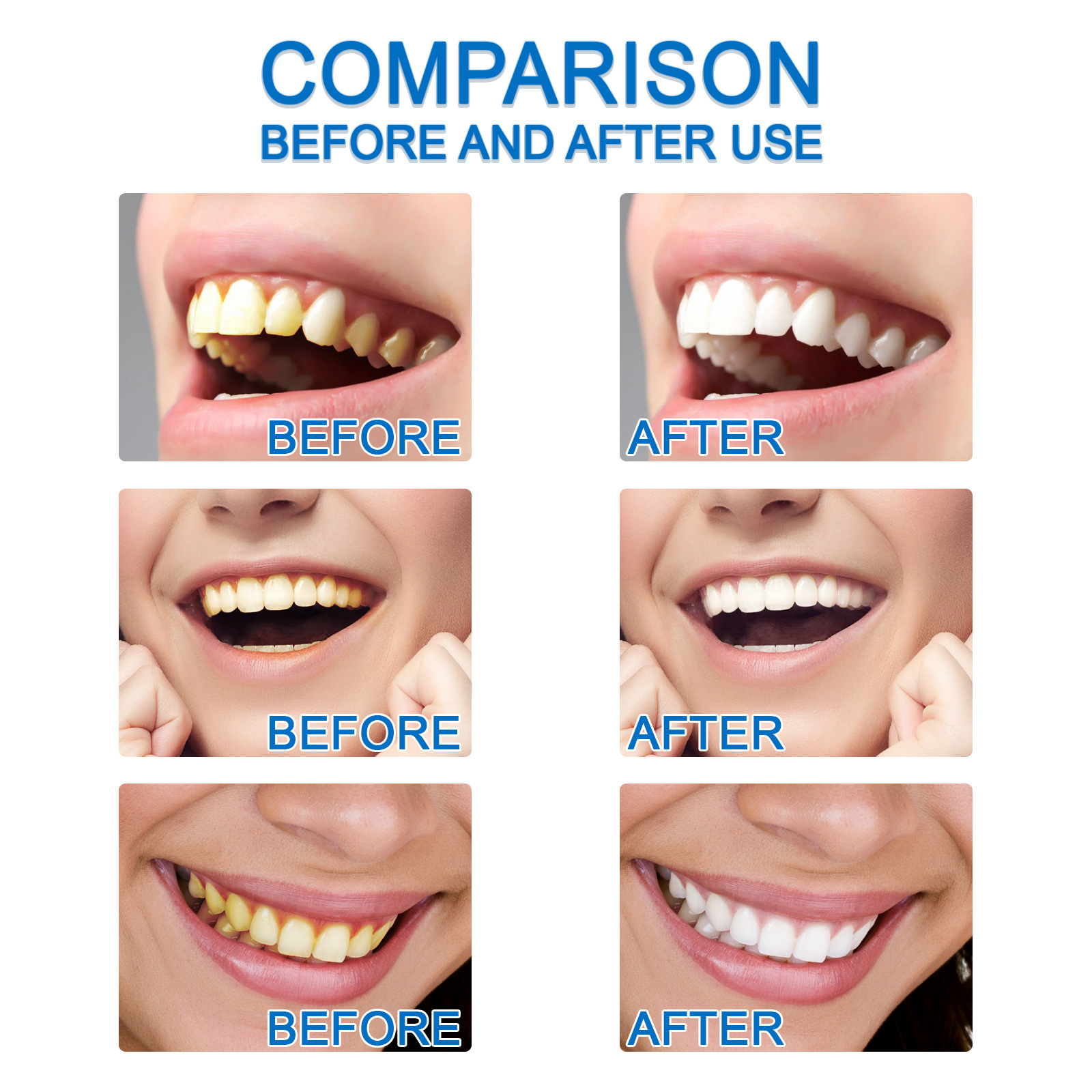 Title 8, Tooth Fluid Improves Yellow Teeth Cleaning Tartar