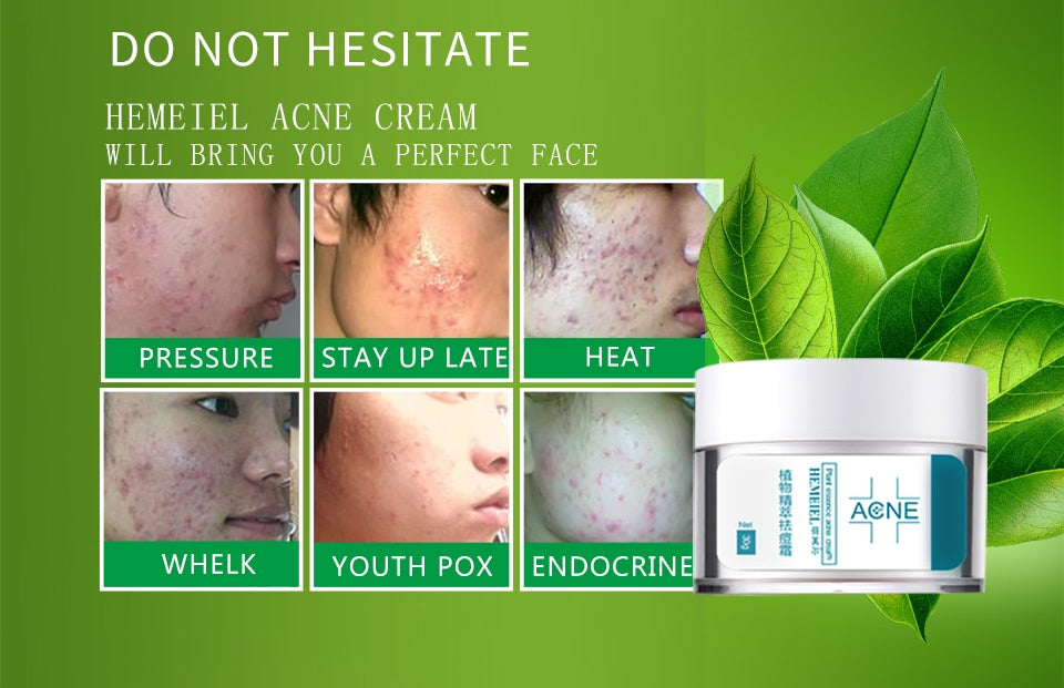 Acne & Scar Removal Cream