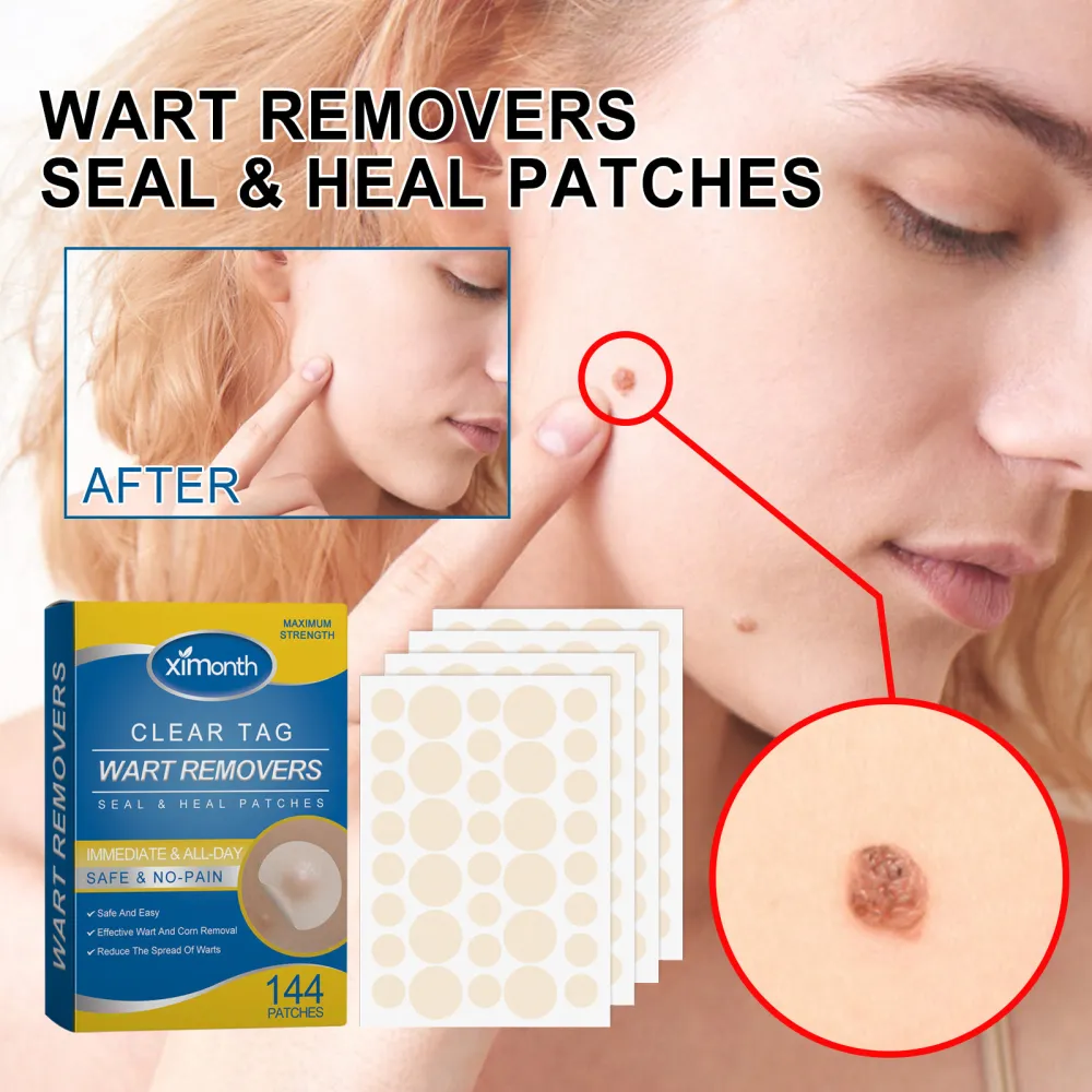 Fade Nevus Wart Repair Flesh Bump Smooth Paste