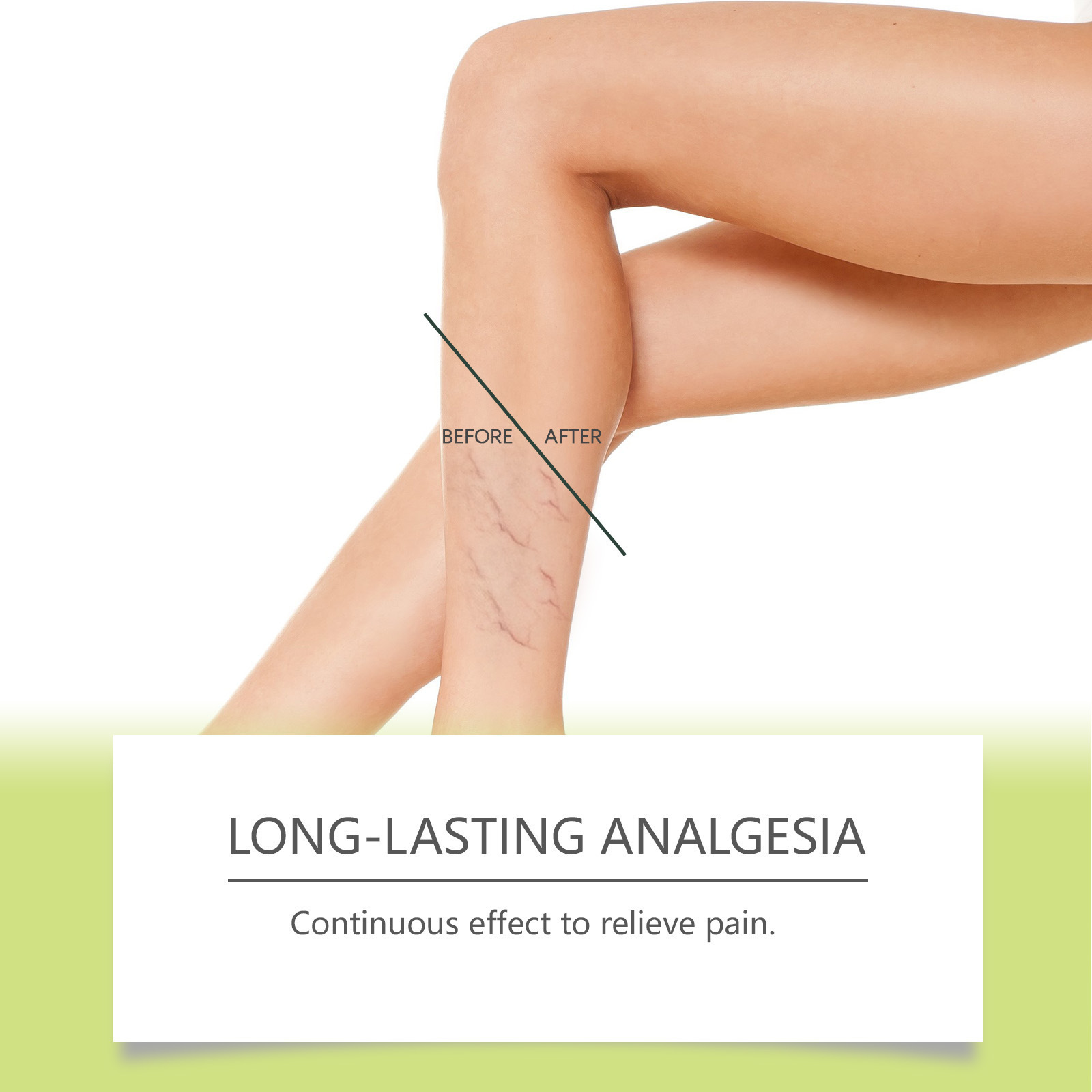 Discomfort-relieving Cream For Preventing Frostbite And Chapped Hands And Feet