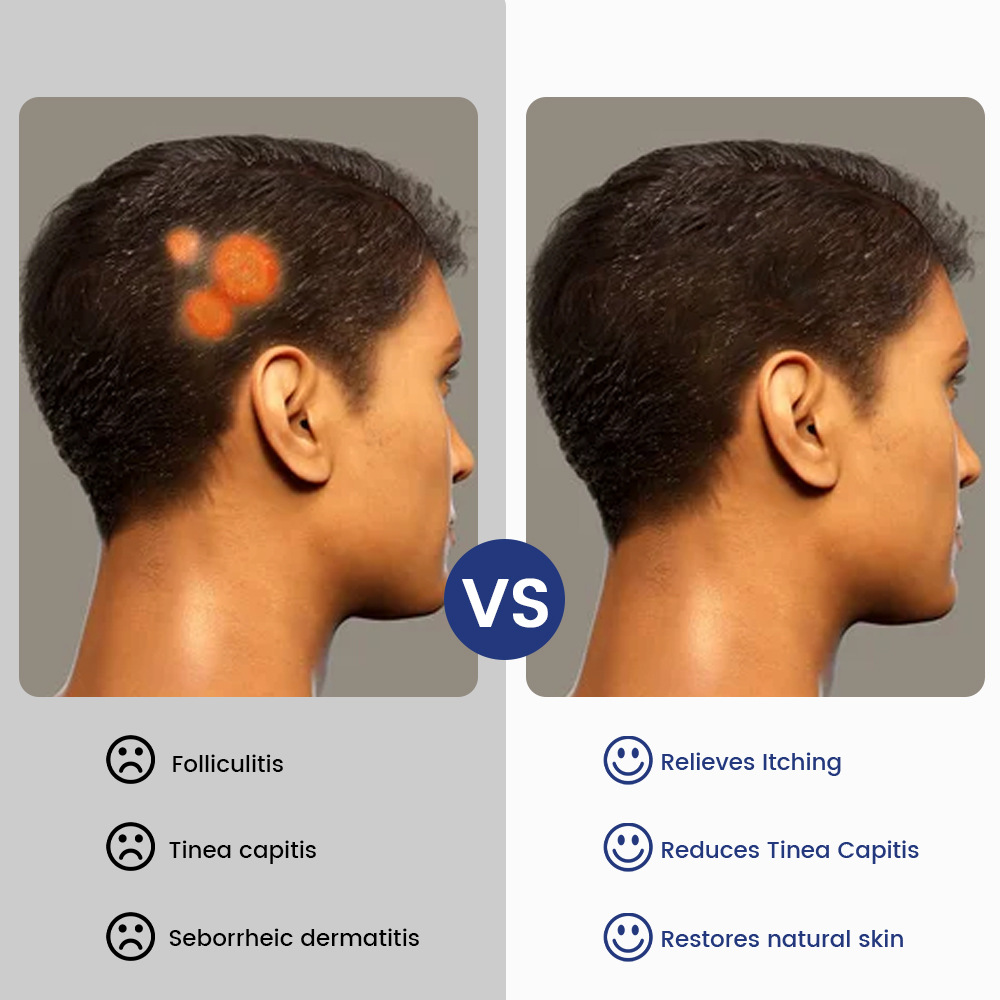 Plaster Tea Tree Oil Skin Care Cream