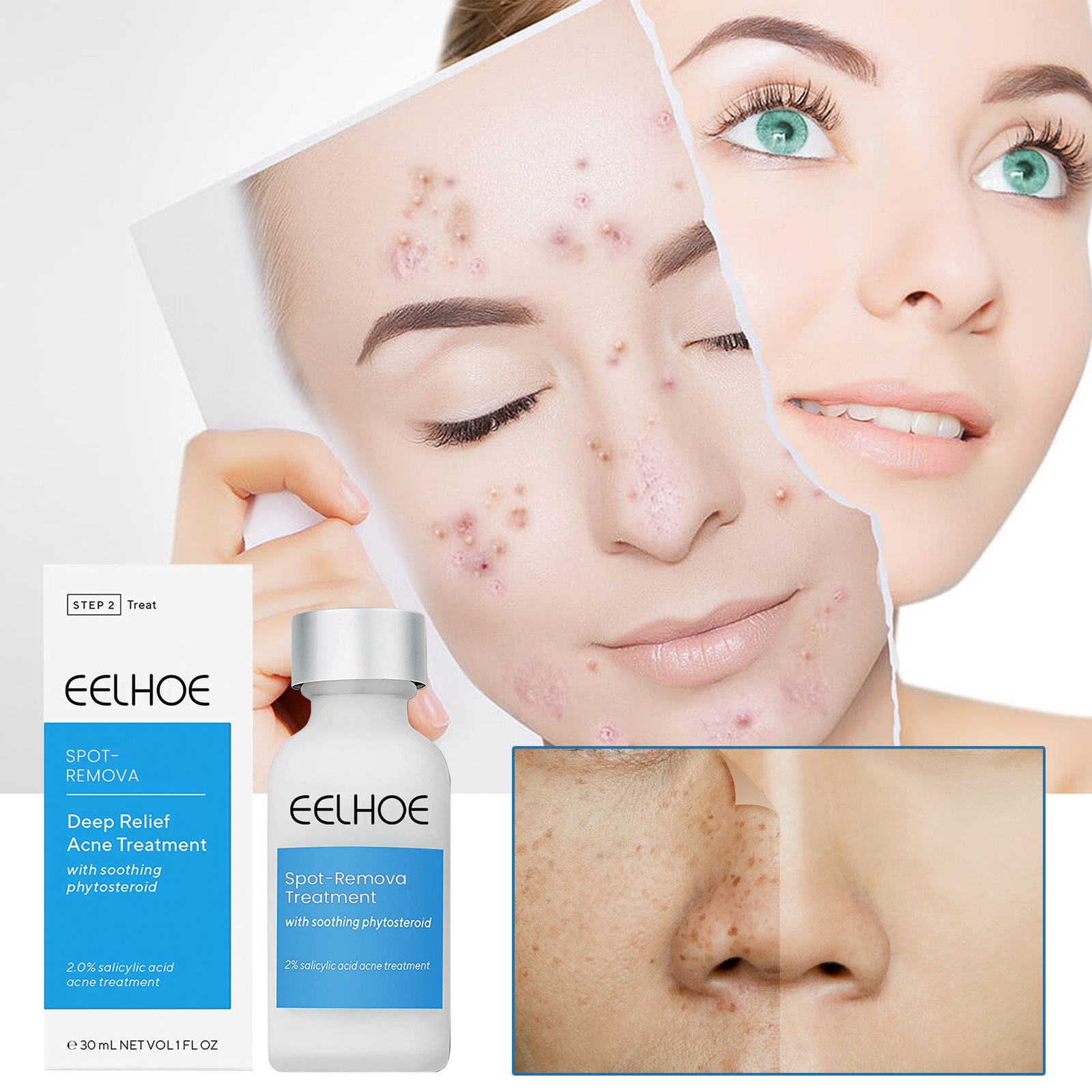 Émulsion anti-boutons — Soin points noirs 30 ml 7