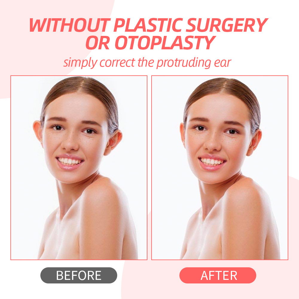 Household Portable Ear Shaping Correction Stickers - Image 2