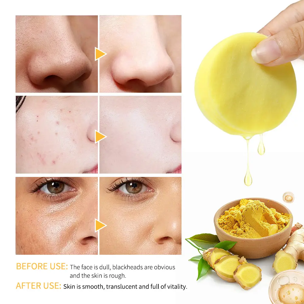 Turmeric Kojic Acid Is Mild And Does Not Stimulate Delicate Pores Clean Cotton Sheet