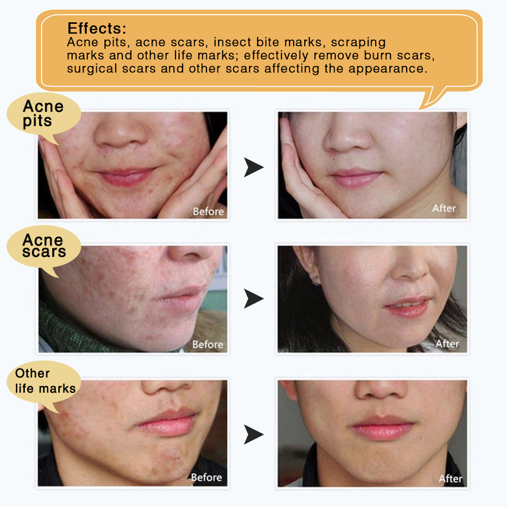 Title 9, Scaling no trace repair arsenic