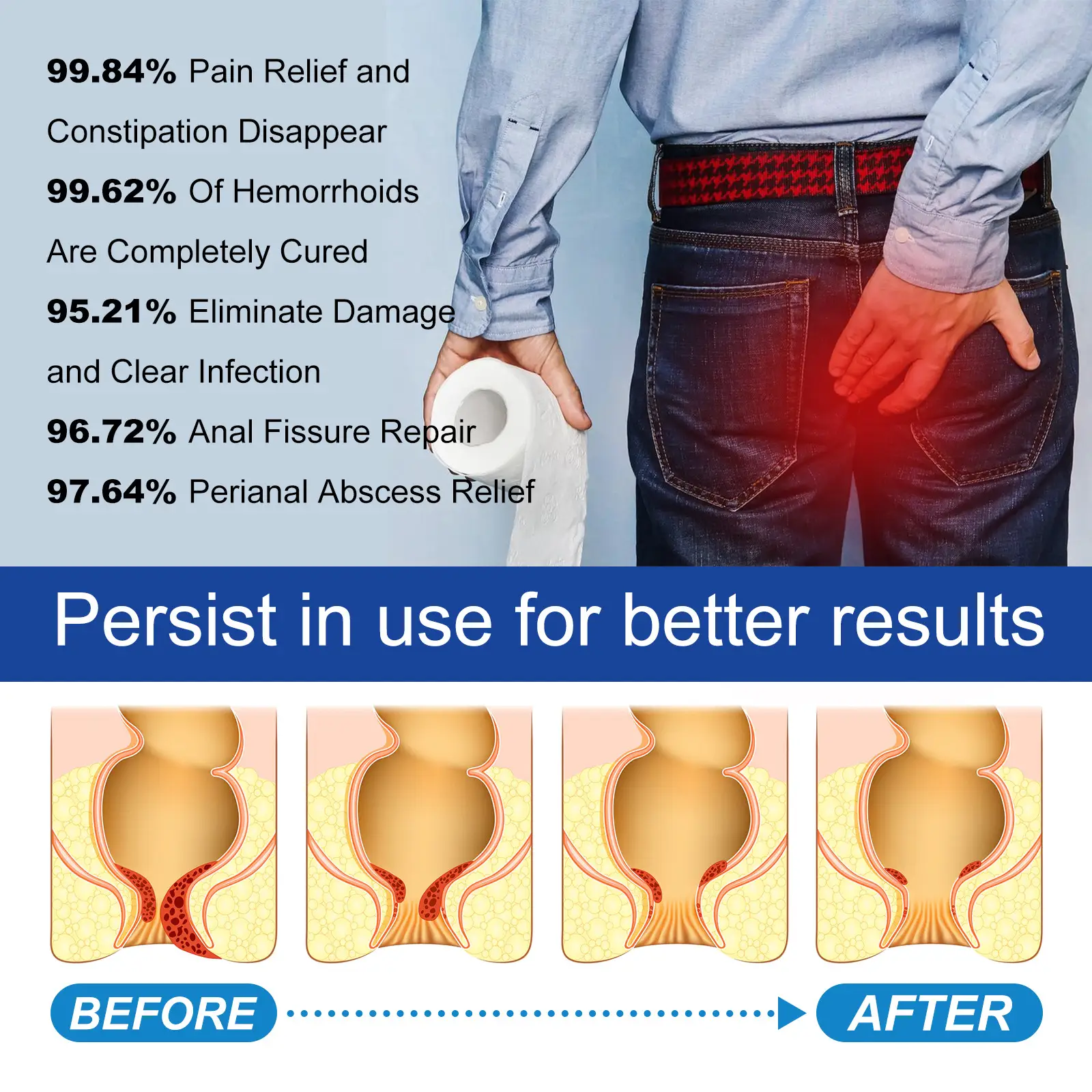 Herbal Hemorrhoids Capsule Repair And Relieve Itching