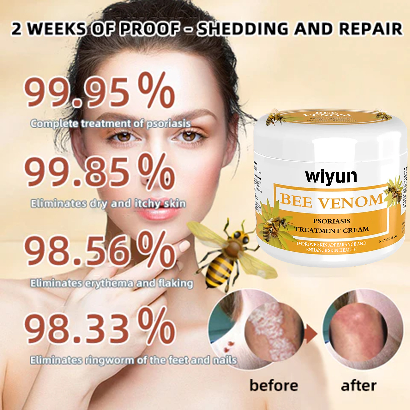Crème mains et pieds au venin d'abeille — Soin réparateur 30 g 5