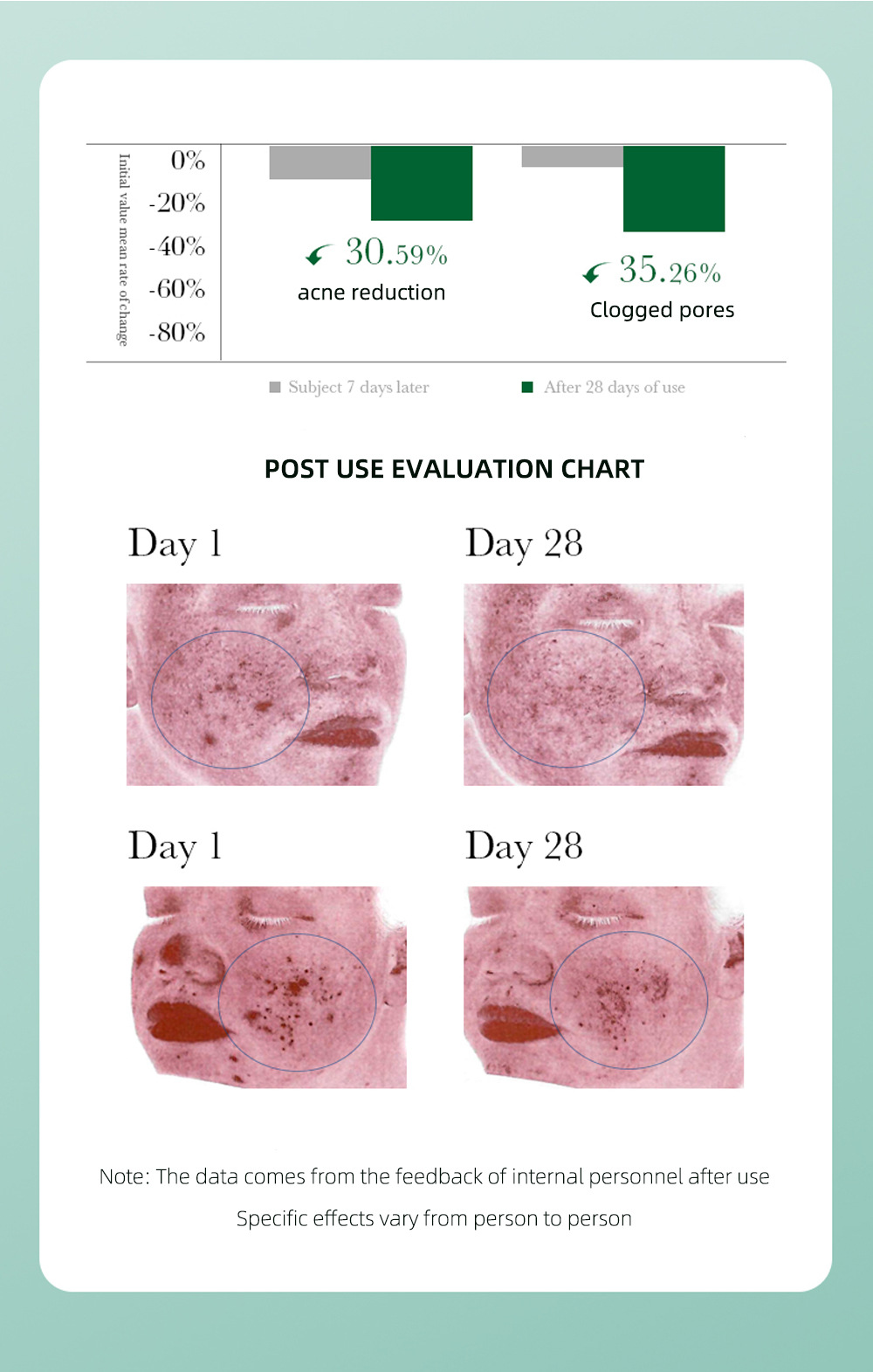 Title 5, Tea Tree Acne Removing Box Skin Care Set