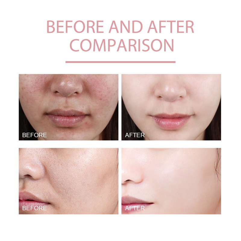 Nicotinamide Care Solution Hydrating And Moisturizing Improvement