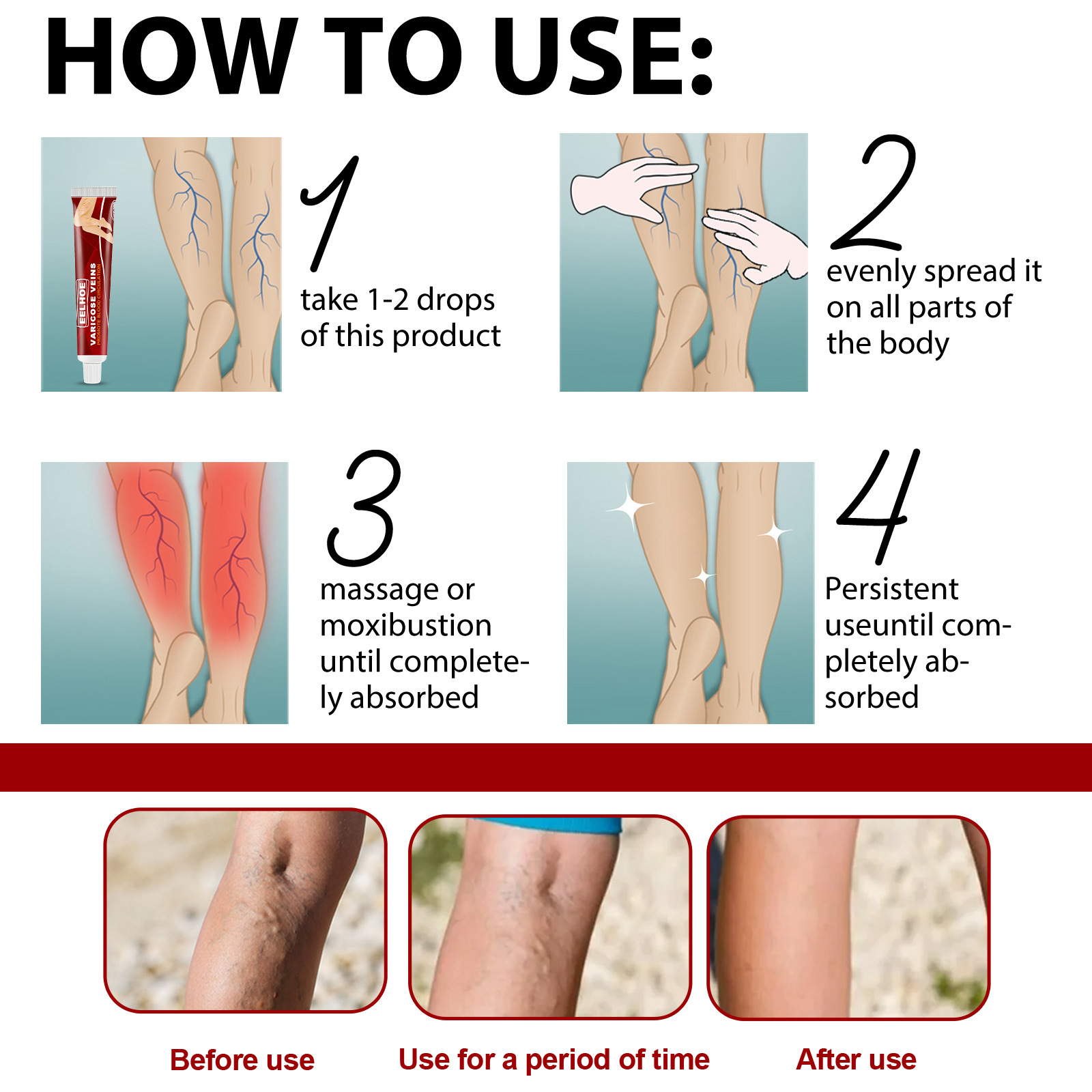 Title 4, Earthworm Leg Vein Massage Cream Relieves Leg V...