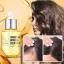 35Ml