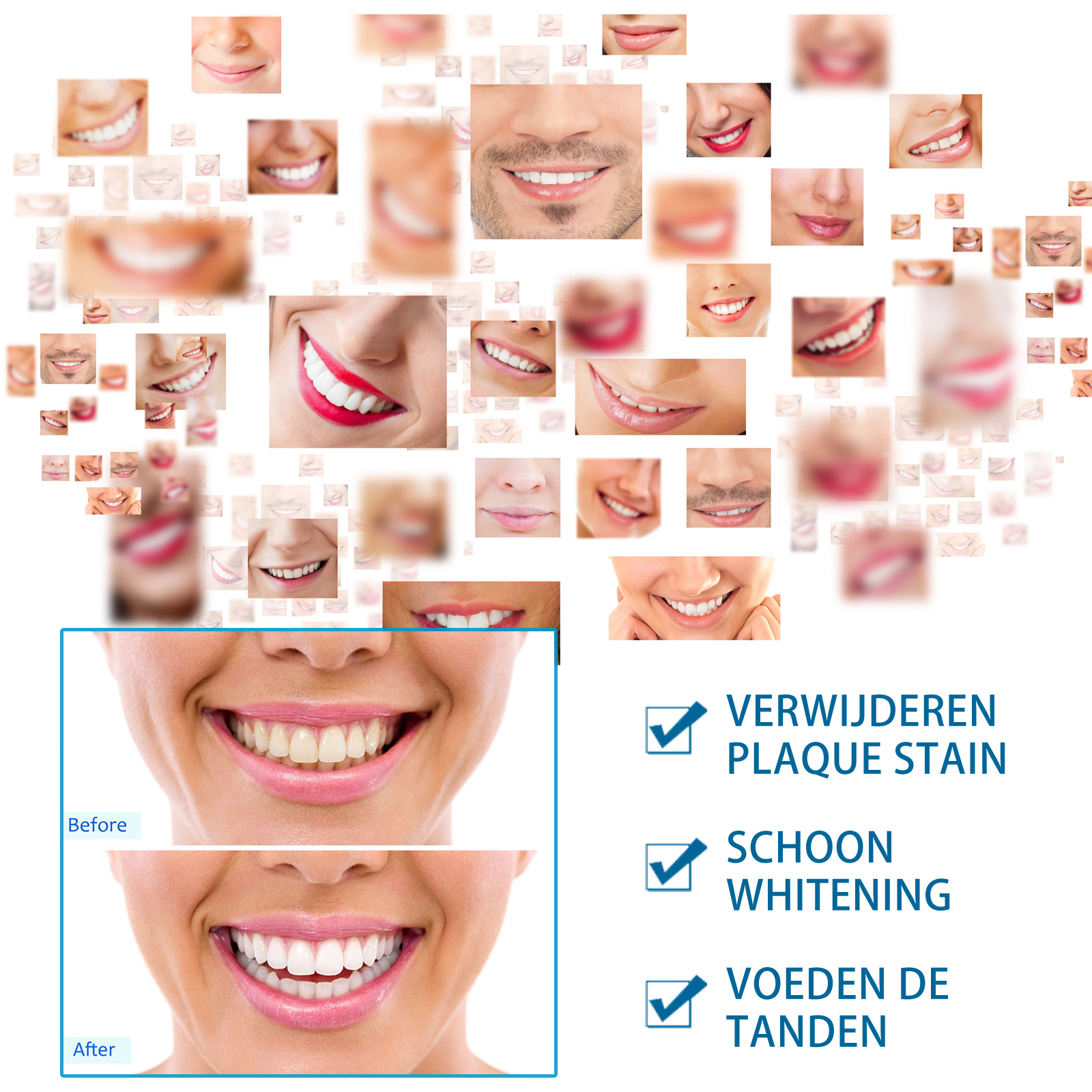 Teeth White Pen Oral Cleaning Beautiful Tooth Brightening