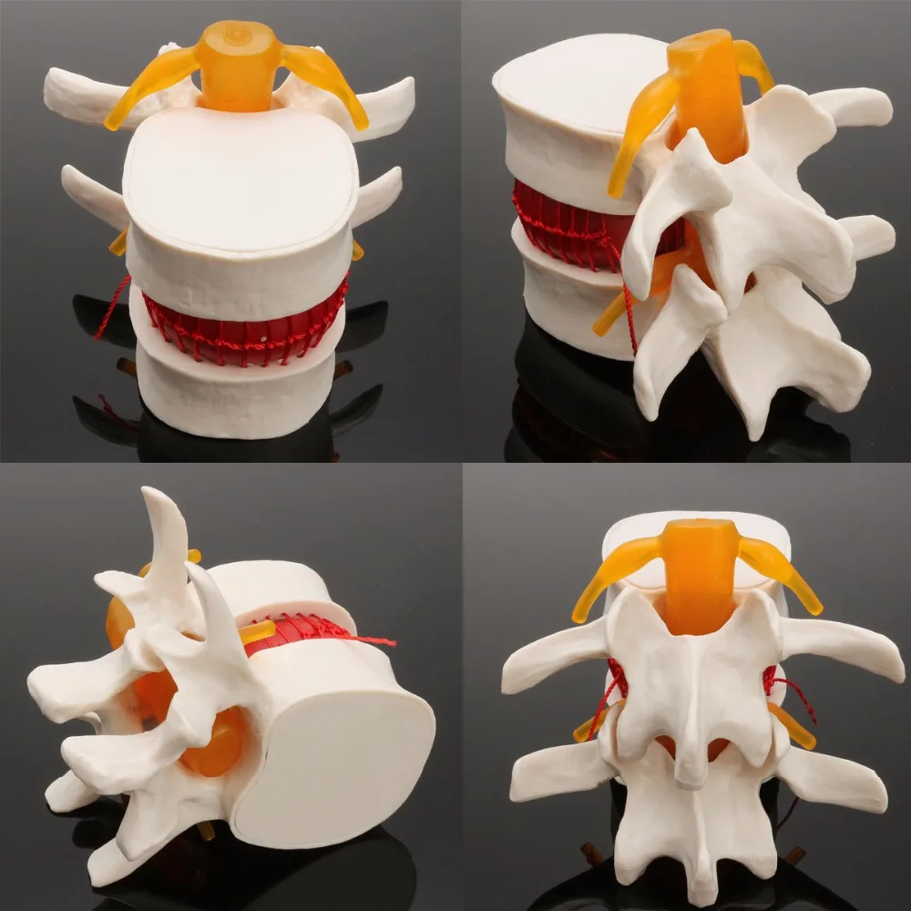 Title 1, Demonstratiemodel van de menselijke lumbale tus...