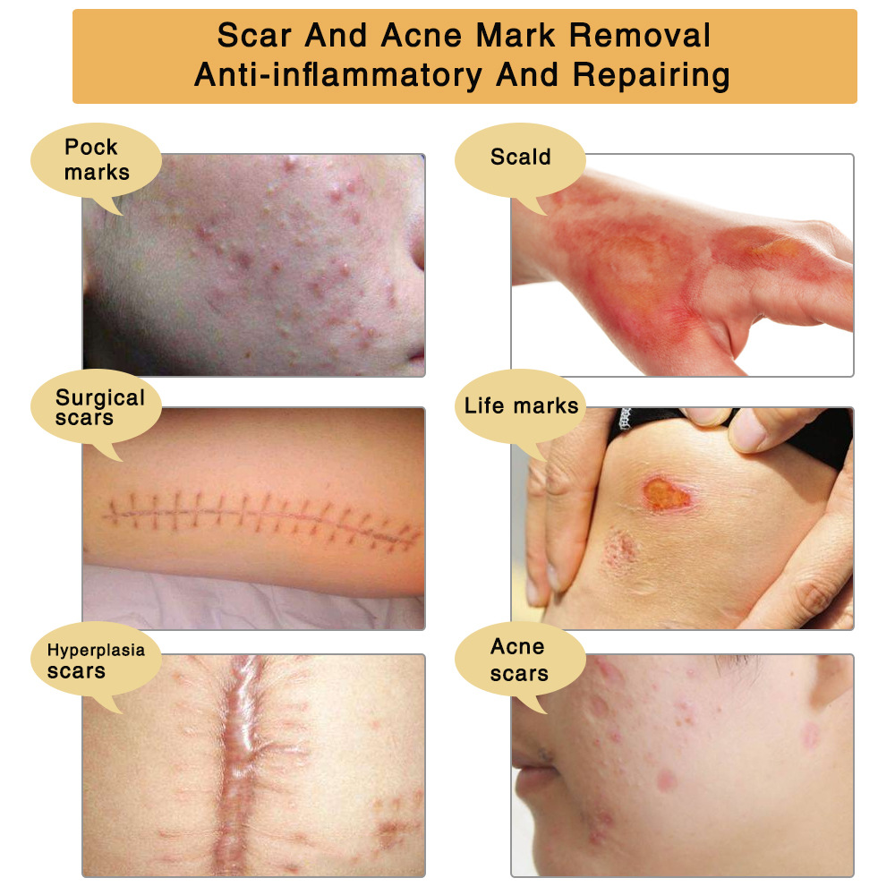 Title 10, Scaling no trace repair arsenic