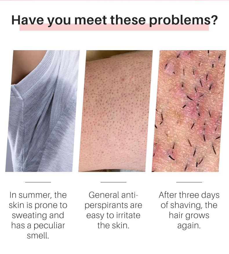 Hair Suppression Body Lotion 7