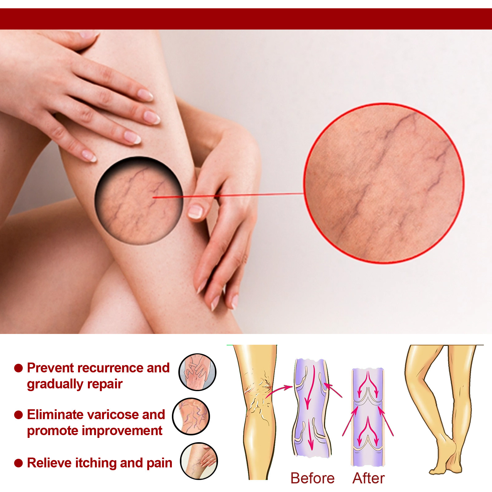 Title 5, Earthworm Leg Vein Massage Cream Relieves Leg V...